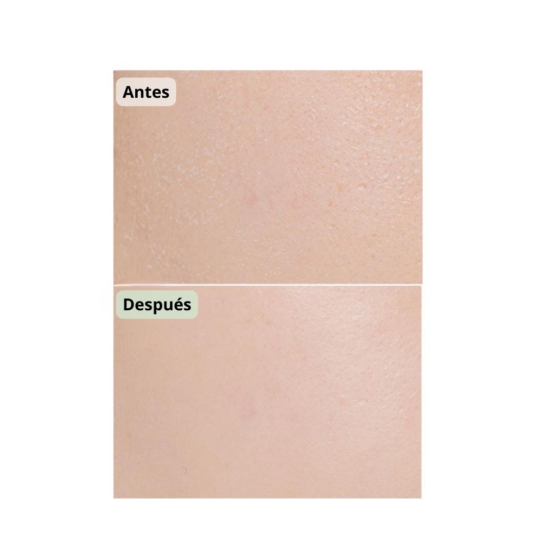 Exfoliante Facial Clean it Zero Tea tree Pore Peeling Gel Banila